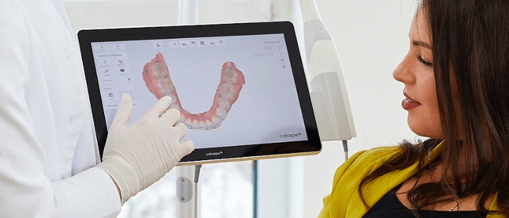 Frau bekommt ihre Zähne im 3D Scan von ihren Zahnarzt gezeigt um ein strahlendes Lächeln mit DR SMILE Zahnschienen zu bekommen