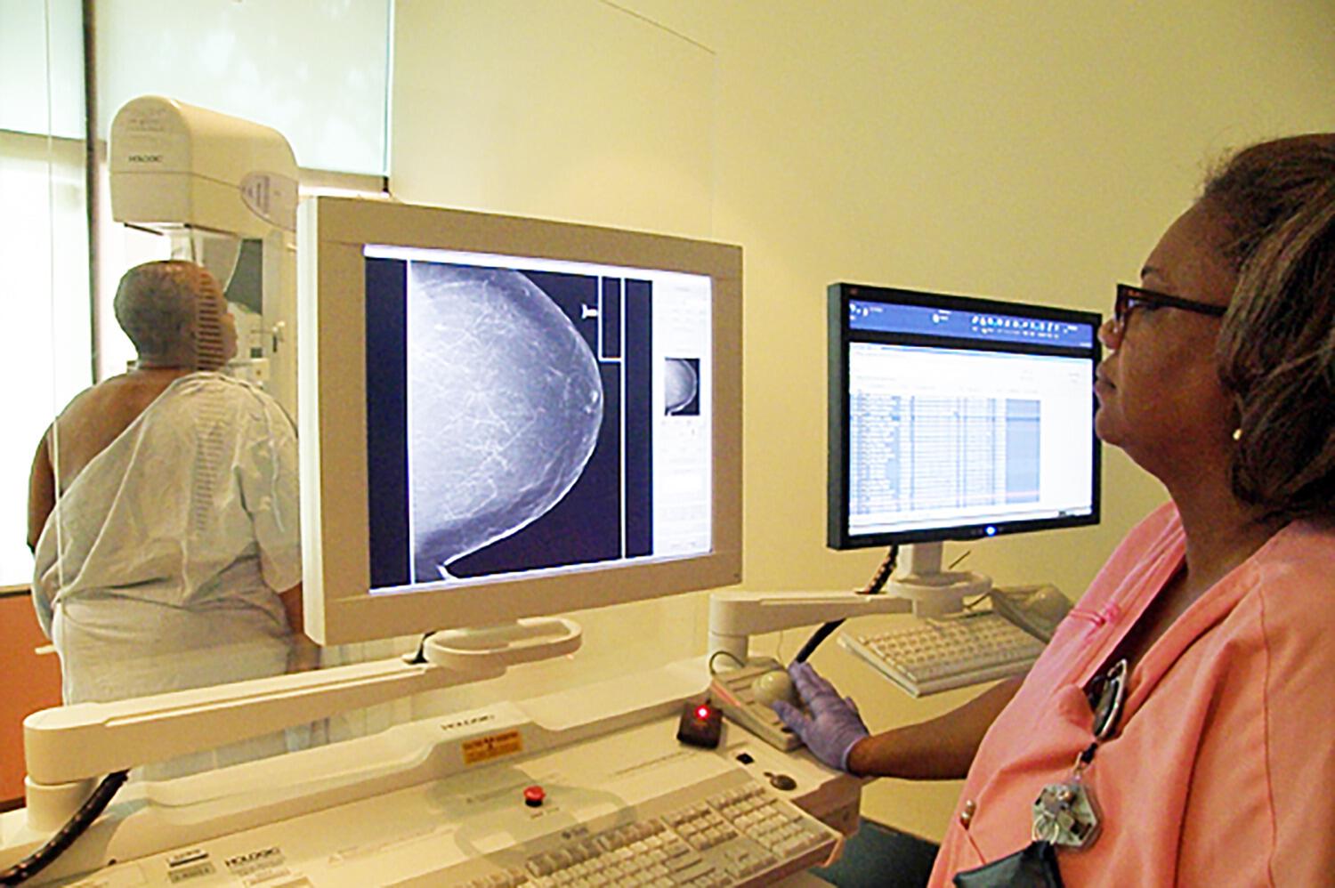NBCF National Mammography Program